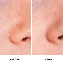 Ginseng Micro Shot Starter