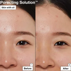 Porecting Solution