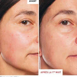Skin Therapy