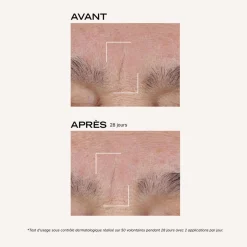Suprême Absolu